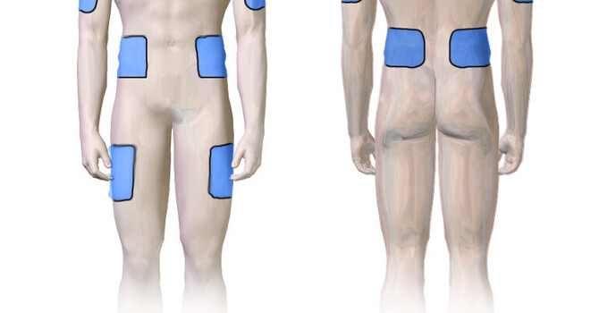 HGH Injection Sites in Children image