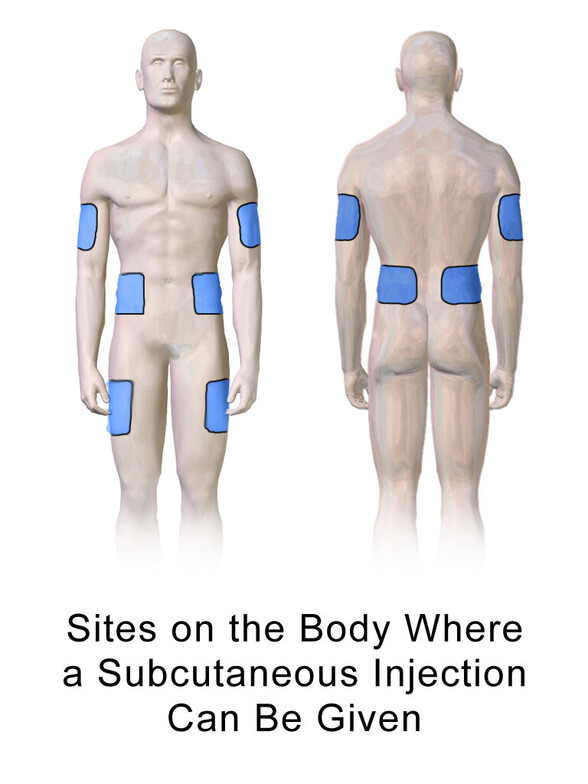 HGH Injection Sites in Children